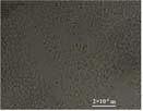 Microstructures of water-in-water poly(acryl amide)